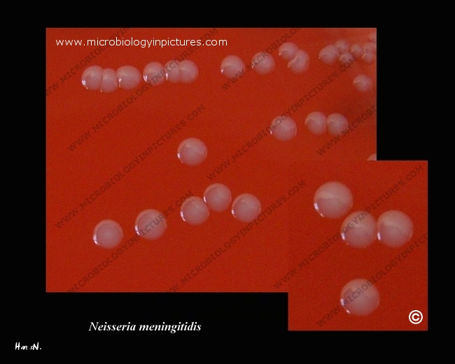 Neisseria meningitidis colonies neisseria meningitidis colony morphology on blood agar